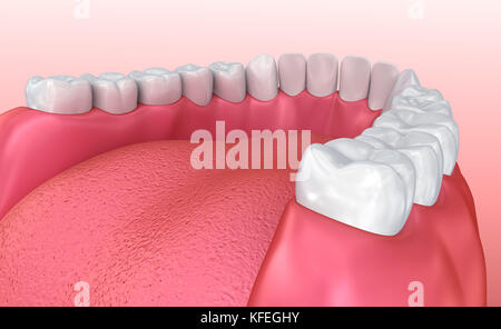 Mund, Zahnfleisch und Zähne. Medizinisch genaue Zahn 3D-Illustration Stockfoto