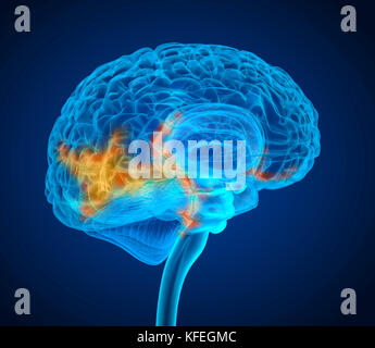 Human Brain Tumor X-ray-Scan, Medizinisch genaue 3D-Darstellung Stockfoto