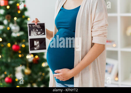 Schwangere Frau mit Ultraschall Bilder zu Weihnachten Stockfoto