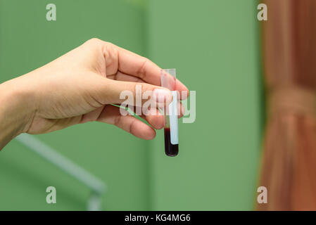 Hand mit einem Rohr der Blutprobe im Labor Stockfoto