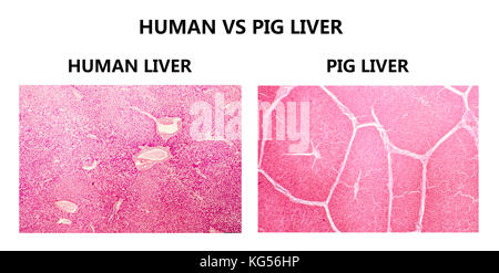 Mensch und Schwein Lebern. Licht Schliffbild mit Gewebe von einer gesunden menschlichen Leber (links) und ein Schwein Leber (rechts). Das Schwein Leber hat gut abgegrenzten Läppchen mit dicken interlobal Bindegewebe. Stockfoto