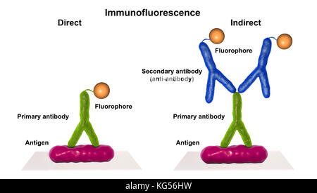 Mechanismus der indirekte Immunfluoreszenztest, computer Abbildung. Immunfluoreszenz ist ein cell imaging Technik basiert auf der Verwendung von Antikörpern gegen das Label ein spezifisches Ziel Antigen (Bakterien, Krebszellen, Andere) mit einem fluoreszierenden Farbstoff (auch als fluorophor oder FLUOROCHROM). Die fluoreszierenden Farbstoff ermöglicht die Visualisierung des Antigens Verteilung in der Stichprobe unter einem Fluoreszenz-mikroskop. Die indirekte Immunfluoreszenz verwendet zwei Antikörper, die primären und die sekundären. Stockfoto