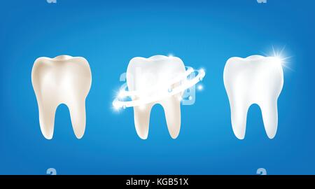 Ansammlung von Schmutz reinigen und kräftigen weißen Zähnen mit glitzernden helles Licht element auf blauem Hintergrund illutration Vector EPS 10. Stock Vektor