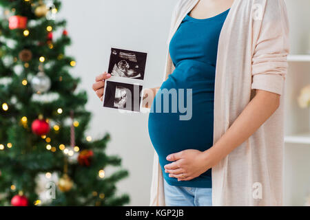 Schwangere Frau mit Ultraschall Bilder zu Weihnachten Stockfoto