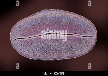 Rizinusöl Saatgut, LS darkfield photomicrograph Rizinusöl Ricinus communis seed TS, die castorbean oder rizinus-Anlage Stockfoto