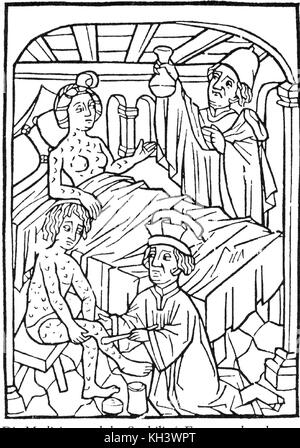 Syphilis. Eine frühe medizinische Illustration von Menschen mit Syphilis, Wien, 1498 Stockfoto