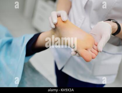 Warze am Fuß des Patienten Stockfoto