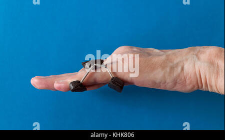 Finger Schiene auf ein wenig 'Pinkie' Finger nach der Dupuytren Kontraktur korrektive Chirurgie Finger zu begradigen und Narbengewebe entfernen. Stockfoto
