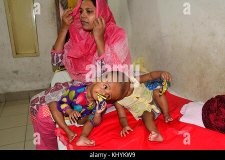 Dhaka, Bangladesch. 20.. November 2017. Am 20. November 2017 spielen die beiden Zwillingsmädchen Rabeya Islam und Rokeya Islam in einem Krankenhaus für medizinische Collage in Dhaka, Bangladesch. Taslima Khatun, eine Schullehrerin, gebar am 16. Juli 2016 nach einem Kaiserschnitt die beiden beigesellten Zwillinge. Die Zwillinge wurden in ein Dhaka Medical Collage Hospital zur Untersuchung eingeliefert, bevor sie möglicherweise operiert wurden, um ihren Kopf zu trennen. Stockfoto