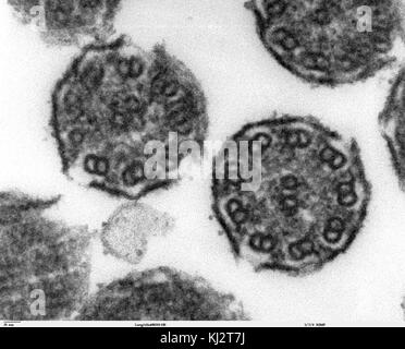 Bronchiolar Bereich zilien Querschnitte 2 Stockfoto