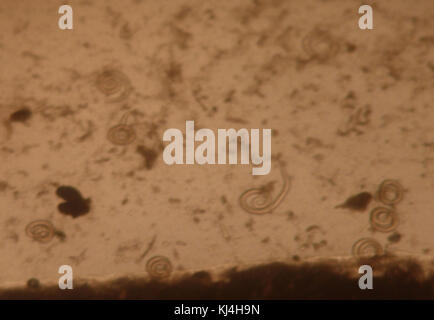 Trichinelladigestion 2 Stockfoto