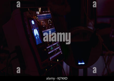 Nahaufnahme Beleuchtung Life Support Daten auf der modernen Herz, Gehirn, Nieren Vorsorgeuntersuchungen Ausrüstung während der Operation Operation. Medizin, Gesundheit Stockfoto