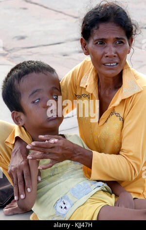 Khmer Frau und Kind betteln hydrocephalic außerhalb von Angkor Wat. Kambodscha. Stockfoto