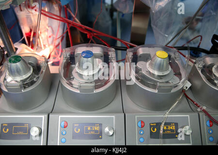 Op. Der herzchirurgie. Kardioplegie. Vietnam. Stockfoto