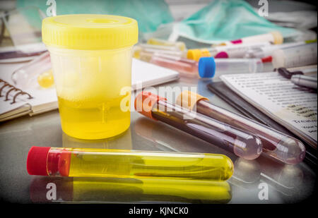 Einige Fläschchen mit Proben von ansteckenden Krankheiten in einem klinischen Labor Stockfoto