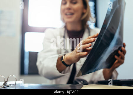 Arzt erklären medizinische Ergebnis zu Patienten in der Klinik. Medizin Praktiker mit Röntgendiagnostik diskutieren. Stockfoto