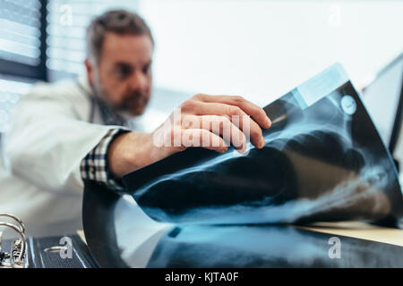In der Nähe des Doctor's Hand Kommissionierung ein x-ray von seinem Schreibtisch. Männliche Arzt sitzt in seinem Büro und Prüfung von medizinischen Scan. Stockfoto