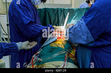 Chirurgen führen Sie die Operation durch. closeup von Doctor's Hand in Handschuhe während der Operation. Gesundheitswesen und medizinische Konzept. aseptischen chirurgischen Instrumenten Stockfoto