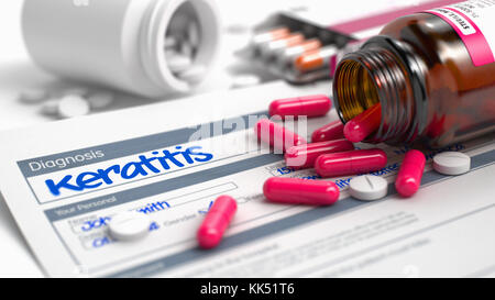 Keratitis - Phrase in Differentialdiagnosen. 3d. Stockfoto