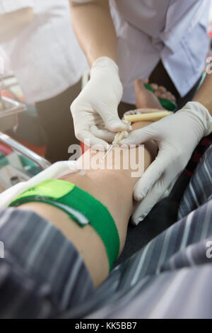 Krankenschwester, die Blut von blutspender im Krankenhaus. Stockfoto