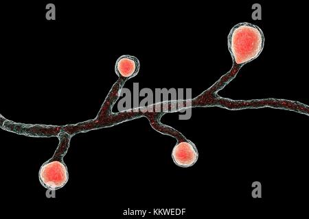 Blastomyces dermatitidis Pilz, computer Abbildung. Dieser Pilz ist der Erreger der Krankheit Blastomykose, das eine Reihe von Präsentationen. Es betrifft vor allem die Lunge und kann eine Grippe - wie Krankheit, eine akute Krankheit ähnlich wie Lungenentzündung, einer chronischen Krankheit wie Tuberkulose oder die möglicherweise tödliche akute respiratorische Syndrom verursachen. In einigen Fällen kann es auf die Haut, Knochen oder Organe ausbreiten und Läsionen. Die Behandlung mit Antimykotika. Stockfoto