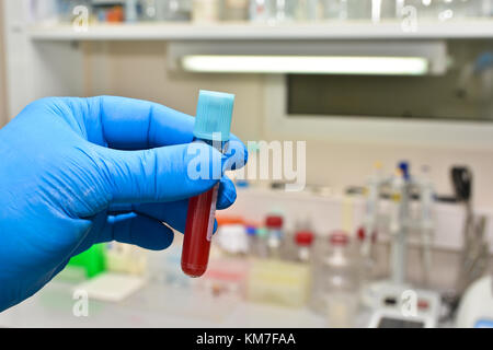 Blutprobe im Labor. Das Reagenzglas mit einer biologischen Probe die Hand in der Latex Handschuh hält. Stockfoto