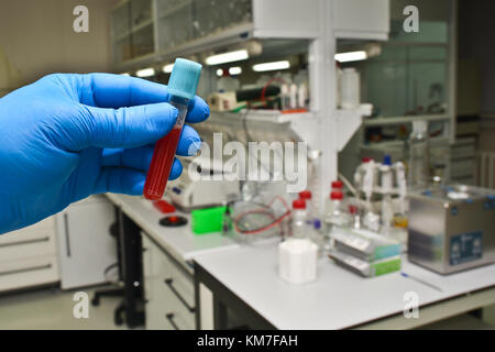 Blutprobe im Labor. Das Reagenzglas mit einer biologischen Probe die Hand in der Latex Handschuh hält. Stockfoto