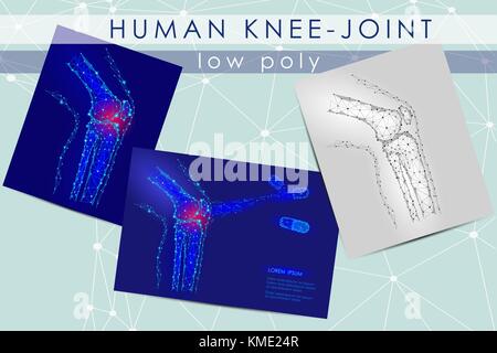 Menschliche Kniegelenk Low Poly Medizin Wissenschaft Abbildung. Knie anatomische Schmerzen heilen Konzept. Hilfe Gesundheit Droge Mechanismus zur gemeinsamen Vektor polygonalen geometrischen Punkt der Linie zu halten Stock Vektor