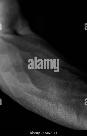 Schwarze und weiße veiny Arm Stockfoto