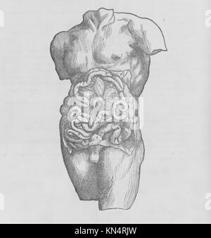 Diese Illustration von „de humani corporis fabrica“ bietet anatomische Details des menschlichen Körpers, die das medizinische Wissen der Renaissance, wissenschaftliche Beobachtung und künstlerische Darstellung widerspiegeln, die in einer Sammlung für Studien und Forschung aufbewahrt werden. Stockfoto