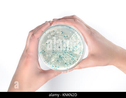 Hände halten Agarplatte mit Bakterienkolonien für Plasmid Vektor klonen Stockfoto
