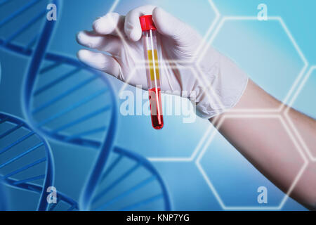 Analyse des dnk. Eine Hand in einem medizinischen Handschuhen hält ein Reagenzglas mit DNA. Bakteriologische Untersuchungen im Labor. Spiralen und Blut Moleküle der DNA. Stockfoto
