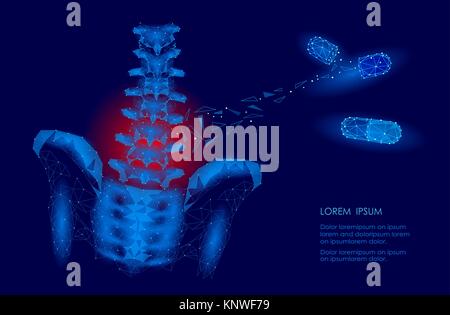 Die menschliche Wirbelsäule Hüfte lumbale Radikulitis Schmerz Low Poly. Geometrische vieleckige Partikelfilter Dreieck Point Line die zukünftige Medizin Technologie blau rot schmerzlichen Bereich Vector Illustration Stock Vektor