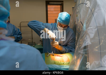 Die WIRBELSÄULENCHIRURGIE Stockfoto