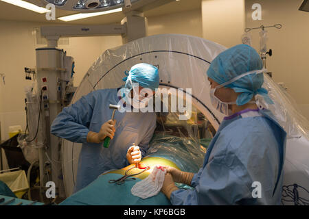 Die WIRBELSÄULENCHIRURGIE Stockfoto