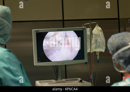 LIGAMENT CHIRURGIE Stockfoto