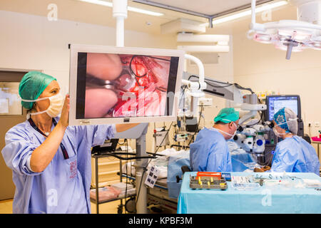 Implantation unter Vollnarkose einer retinalen Prothese Argus® II (Second Sight), Augenabteilung im Krankenhaus von Bordeaux, Frankreich. Stockfoto