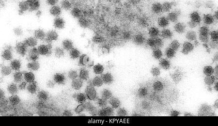 Diese Transmission Electron Micrograph (TEM) Zeigt die Anzahl der West-Nil-Virus (Wnv) Teilchen. Das West-Nil-Virus ist ein Flavivirus häufig in Afrika, Asien und dem Nahen Osten, 2002. Es ist eng mit dem St. Louis encephalitis Virus in den Vereinigten Staaten verwandt. Das Virus kann Menschen, Vögel, Moskitos, Pferde und einige andere Säugetiere infizieren. Mit freundlicher CDC/Cynthia Goldsmith. Stockfoto