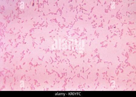 Diese Aufnahme zeigt Bacteroides fragilis ss, 1972. Fragilis kultivierten Bakterien im Blut agar Medium für 48 Stunden. Gram-negative B. fragilis, obwohl ein kommensalen Bakterien, die normalerweise in den menschlichen Magen-Darm-Trakt lebt, unter Umständen Krankheitserreger können bei Störung der normalen Darmschleimhaut wie Trauma oder Chirurgie geworden. Bild mit freundlicher Genehmigung von CDC/Dr. V.R. Dowell, jr. Stockfoto