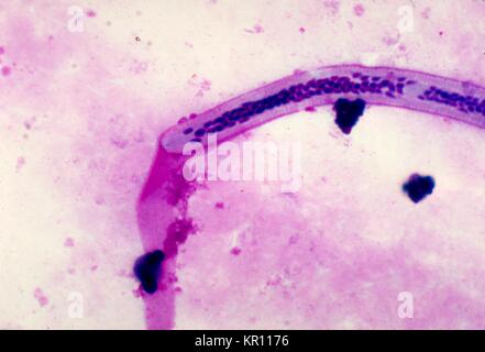 Unter einer Vergrößerung von 1000X, das ist ein photomicrograph offenbart morphologische Details am vorderen Ende eines Wuchereria bancrofti microfilarial Parasiten in einem mit Giemsa Fleck, 1977 Blut verschmiert. W. bancrofti, der häufigsten filarial Parasit im Menschen, ist eines der Erreger, die an lymphatischer Filariose erkrankt sind. Die lymphatische Filariose wirkt sich auf schätzungsweise 120 Millionen Menschen in tropischen Gebieten der Welt. Bild mit freundlicher Genehmigung von CDC/Dr. Mae Melvin. Stockfoto