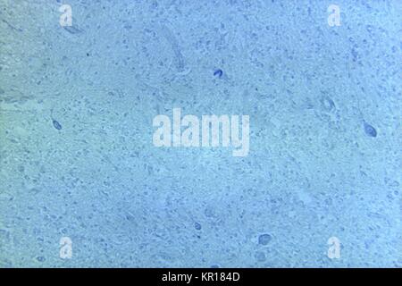 Eine photomicrograph der normalen zervikalen mit cresyl violett Fleck Technik, 1964 cord Gewebe. Cresyl violett färben, hier in diesem Abschnitt des zervikalen Rückenmarks zu beflecken, Anleihen mit sauren Komponenten, dass die neuronalen cytoarchitecture wie Ribosomen, Kerne und Nukleolen umfassen. Bild mit freundlicher Genehmigung von CDC/Dr. Karp, Emory University. Stockfoto