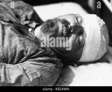 Leo Trotzki (1879-1940) sowjetischer Marxismus revolutionären nach seinem Tod am 21. August 1940, im Alter von 60 Jahren, nach dem Angriff von Ramon Mercader. Stockfoto