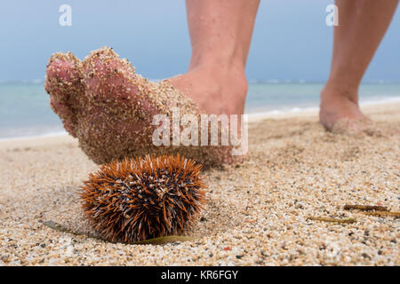Ein Mann geht am Strand entlang und ist etwa auf ein giftiger Seeigel zu treten. Gefahr in den Ferien in einem tropischen Land. Stockfoto