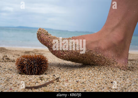 Ein Mann geht am Strand entlang und ist etwa auf ein giftiger Seeigel zu treten. Gefahr in den Ferien in einem tropischen Land. Stockfoto