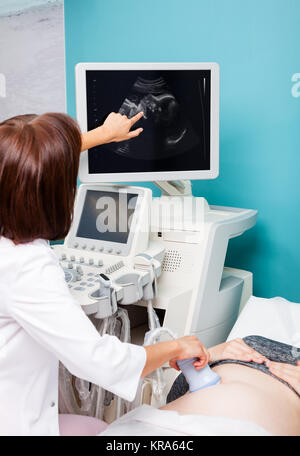 Sonograph Zeigefinger zu bestimmten Punkt Sonogramm eines Fötus dislpaying auf Ultraschall scanner Monitor während der Geburtshilfe ultrasonograp Stockfoto