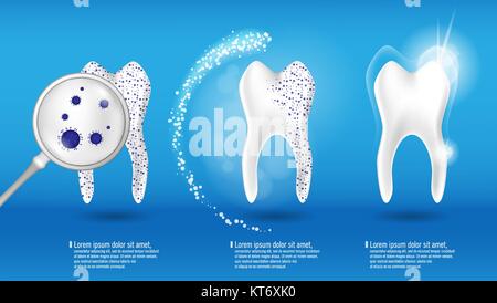 Dental Health Concept Vektor einrichten. 3d realistische glänzend sauberen und schmutzigen Zahn auf blauem Hintergrund, Clearing und Zahnaufhellung Zahn. Oral Care, Zähne Wiederherstellung Stock Vektor