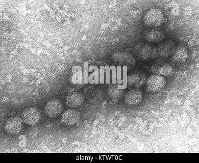 Dies ist eine Transmission Electron Micrograph (TEM) des West-Nil-Virus (Wnv), 2002. Sie PHIL 10701 für eine eingefärbte Blick auf dieses Bild. Das West-Nil-Virus ist ein Flavivirus häufig in Afrika, Asien und dem Nahen Osten. Es ist eng mit dem St. Louis encephalitis Virus in den Vereinigten Staaten verwandt. Das Virus kann Menschen, Vögel, Moskitos, Pferde und einige andere Säugetiere infizieren. Mit freundlicher CDC/EW. Rollin. Stockfoto