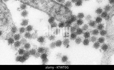 Dies ist eine Transmission Electron Micrograph (TEM) des West-Nil-Virus (Wnv). Das West-Nil-Virus ist ein Flavivirus häufig in Afrika, Asien und dem Nahen Osten, 2002. Es ist eng mit dem St. Louis encephalitis Virus in den Vereinigten Staaten verwandt. Das Virus kann Menschen, Vögel, Moskitos, Pferde und einige andere Säugetiere infizieren. Mit freundlicher CDC/Cynthia Goldsmith. Stockfoto