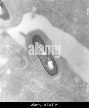 Dies ist eine Transmission Electron Micrograph (TEM) eines Listeria sp, 2002. Bakterium in eine Gewebeprobe. Sie PHIL 10828 für Eine eingefärbte Version dieses Bildes. Listeria monocytogenes ist der Erreger verantwortlich für den durch Lebensmittel übertragenen Krankheit Listeriose. In den USA werden schätzungsweise 2 500 Personen ernsthaft mit listeriose jedes Jahr krank werden. Von diesen 500 sterben. Bild mit freundlicher Genehmigung von CDC/Dr. Balasubr Swaminathan, Peggy Hayes. Stockfoto