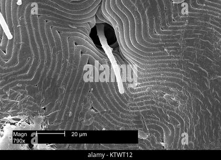 Diese Scanning Electron Micrograph (SEM) zeigt eine Dorsale Ansicht der Rückseite eines American dog Tick, Dermacentor variabilis, Vergrößerung 790X, so dass Sie Details rund um die Basis eines seiner sensiblen 'Haare' als Seta bekannt zu sehen. Zecken sind der Klasse Spinnen, Spinnen und Milben, 2002. D. variabilis ist ein bekannter Anbieter von Rocky Mountain Spotted Fever, verursacht durch das Bakterium Rickettsien rickettsii. Mit freundlicher CDC. Stockfoto